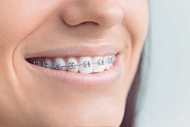 Best Invisalign and Clear Aligners  in Stowell, TX